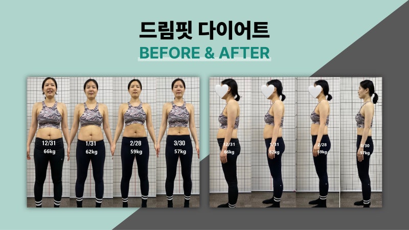 드림핏한의원 전후사진 전후사진