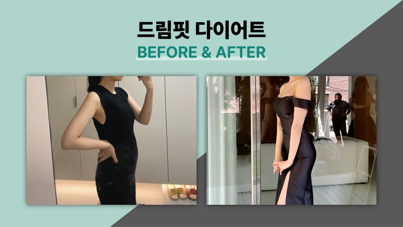 드림핏한의원 전후사진 전후사진