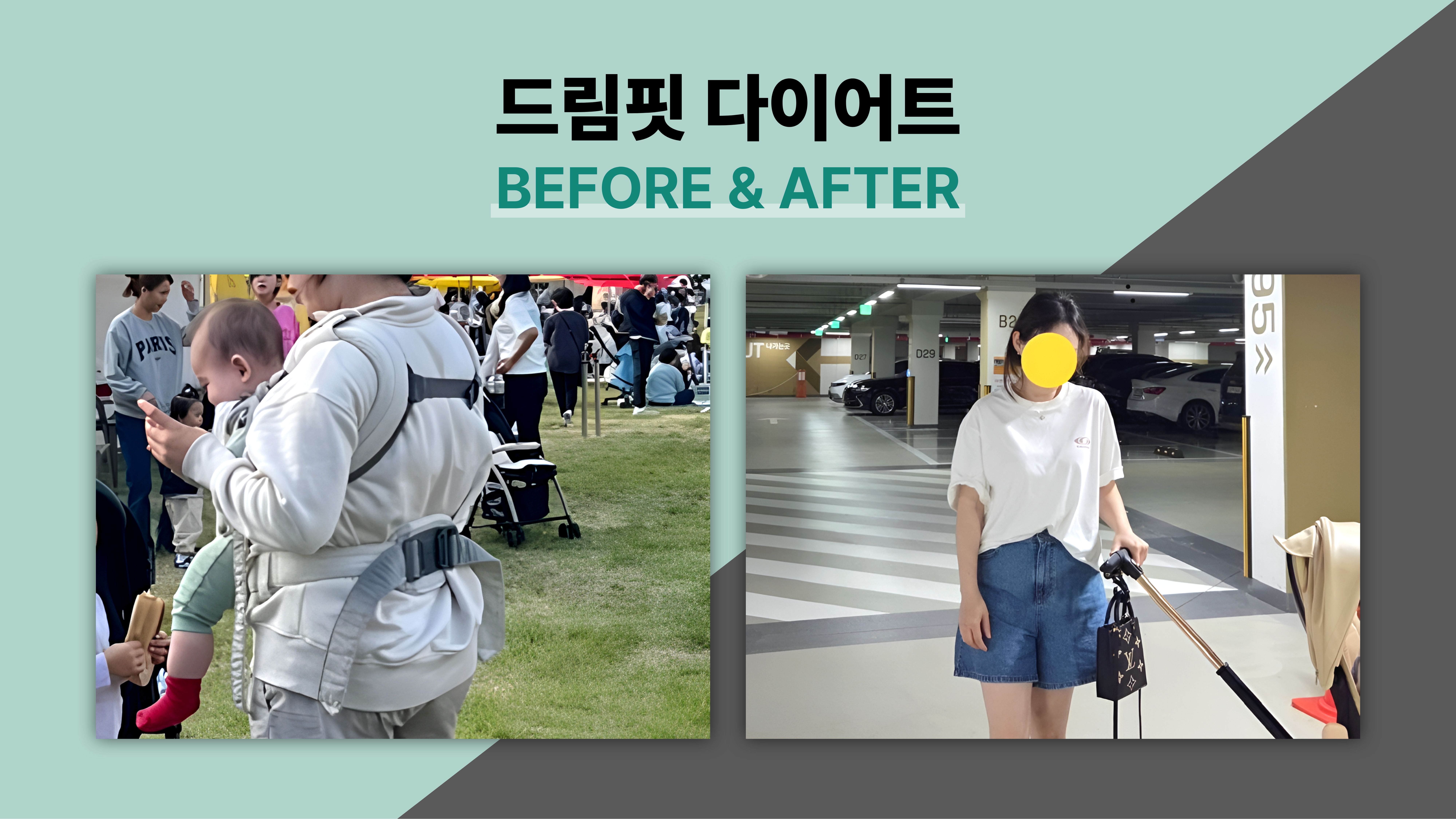 드림핏한의원 전후사진 전후사진