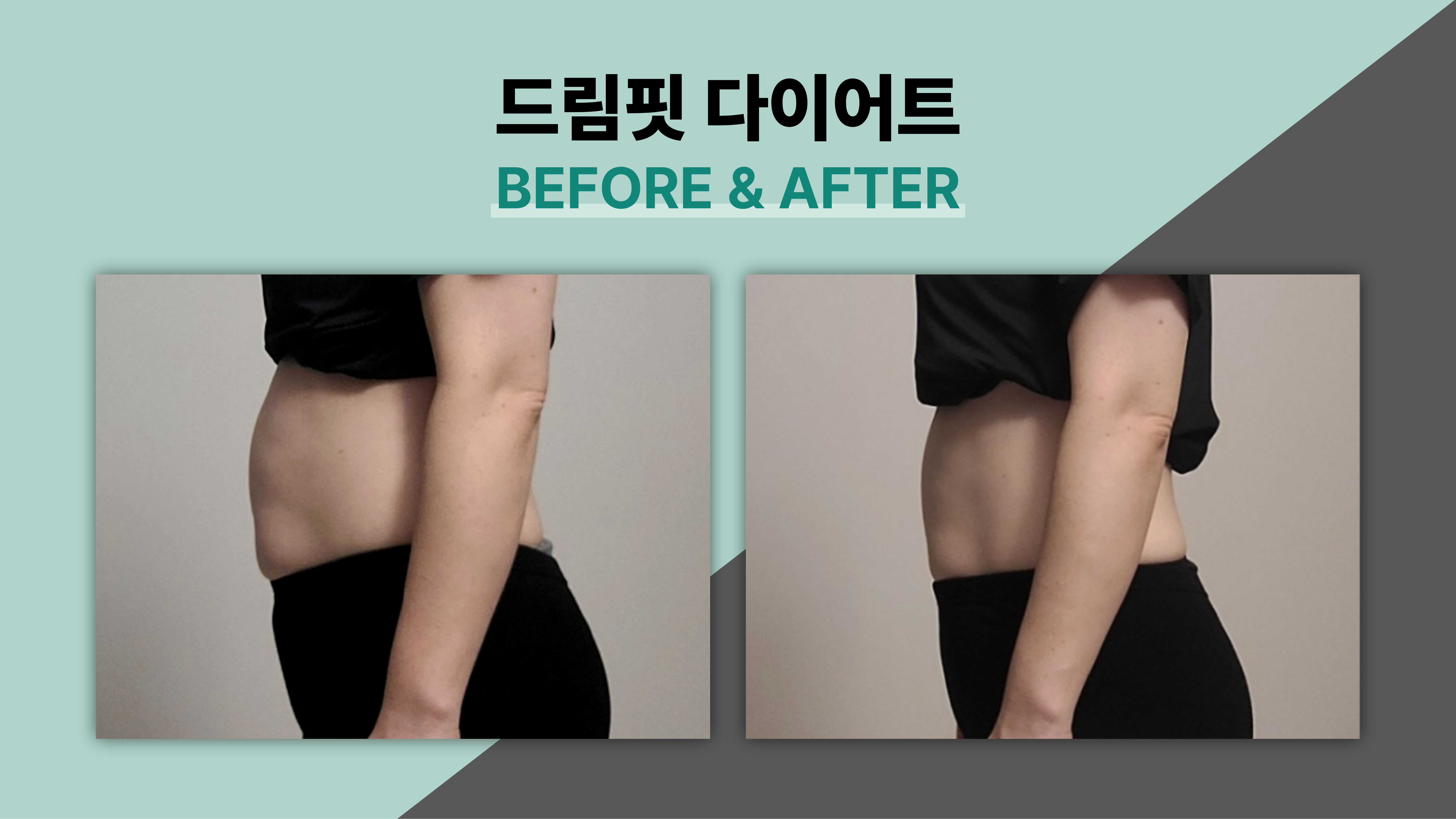 드림핏한의원 전후사진 전후사진