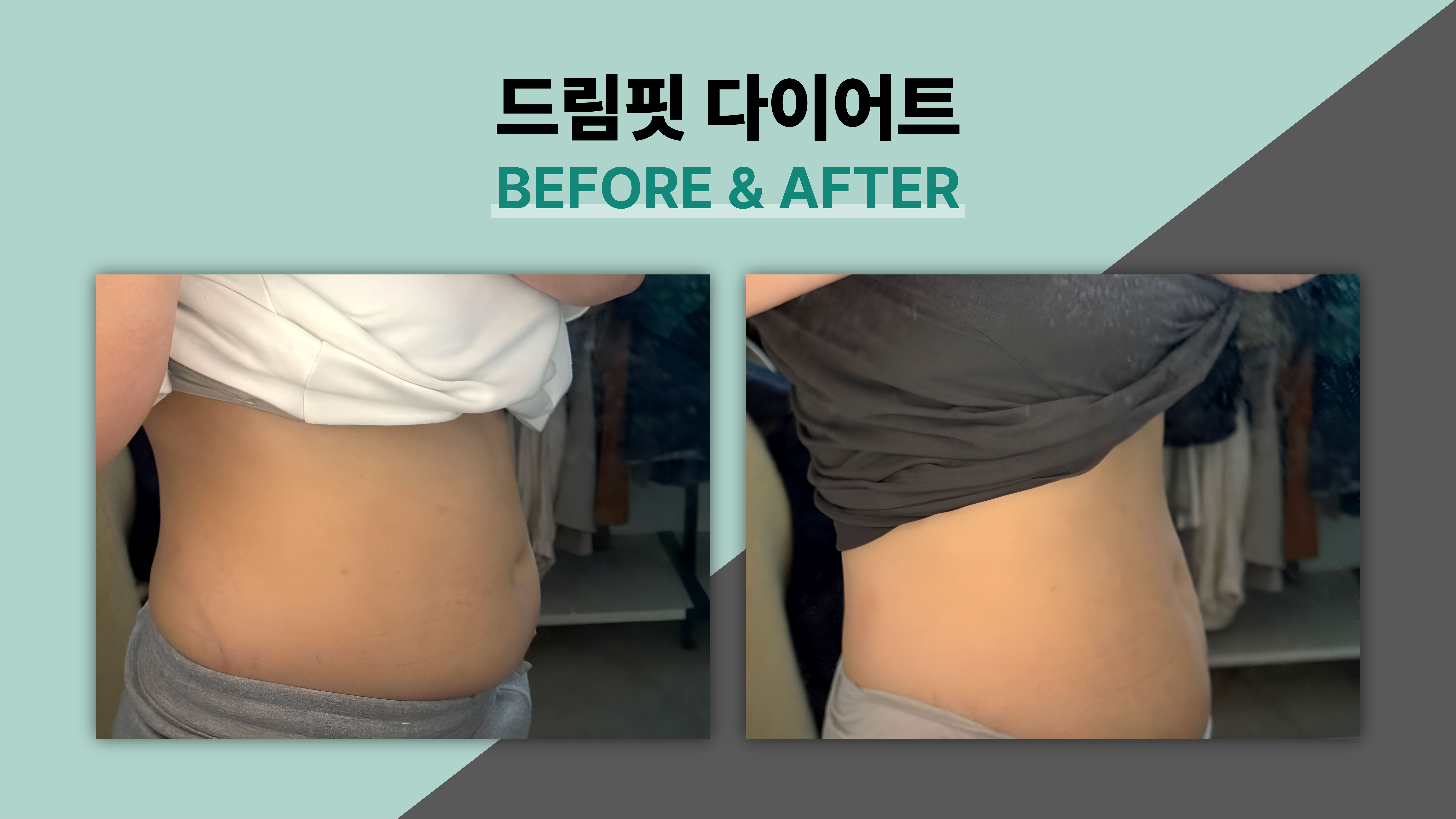 드림핏한의원 전후사진 전후사진